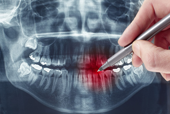 RaioClin Centro de Radiologia Odontológico
